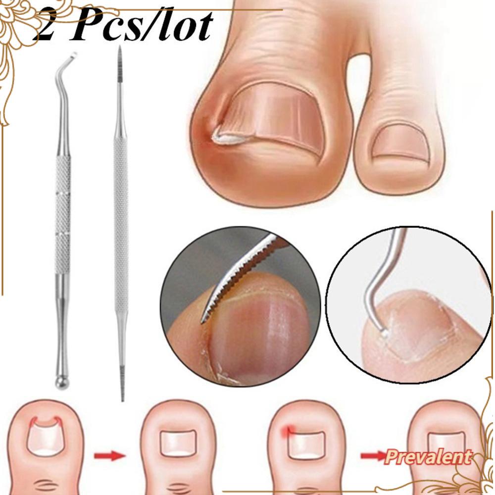 Preva 2Pcs/Set Kuku Kaki Ingrown Profesional Kutikula Pendorong Pembersih Kuku Paronychia