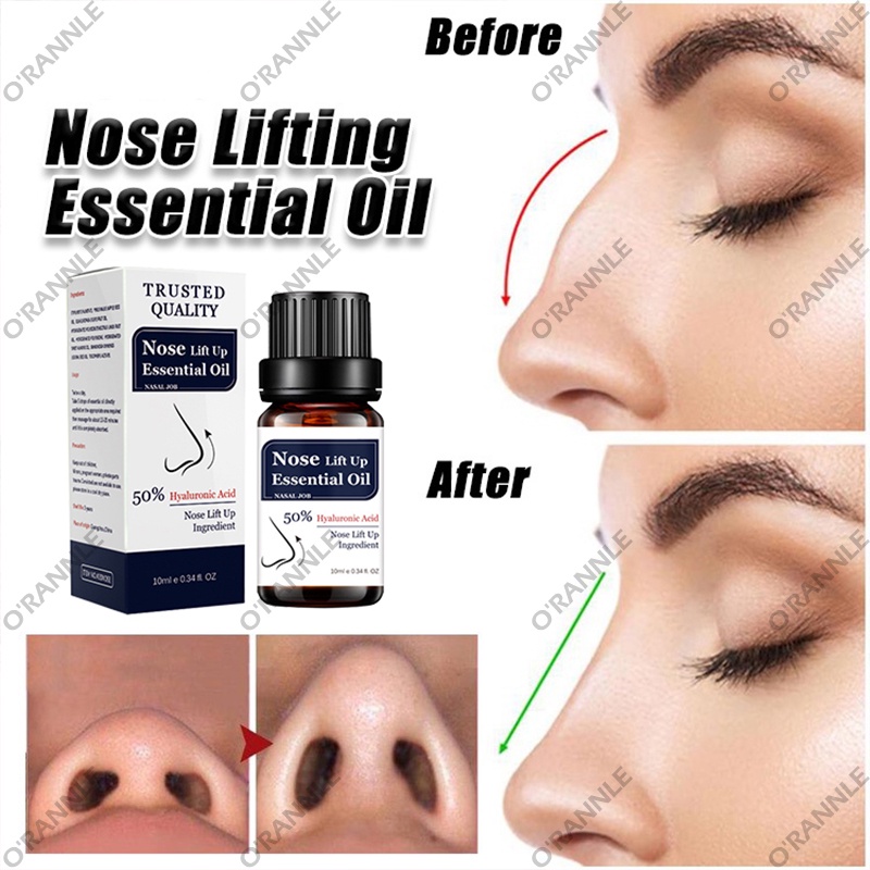 【100% ORIGINAL】cairan peninggi batang hidung Alat hidung pemancung hidung alat pemancung hidung 10ml Nose lift up essential oil Hidung Cepat Memancungkan hidung menjadi mancung