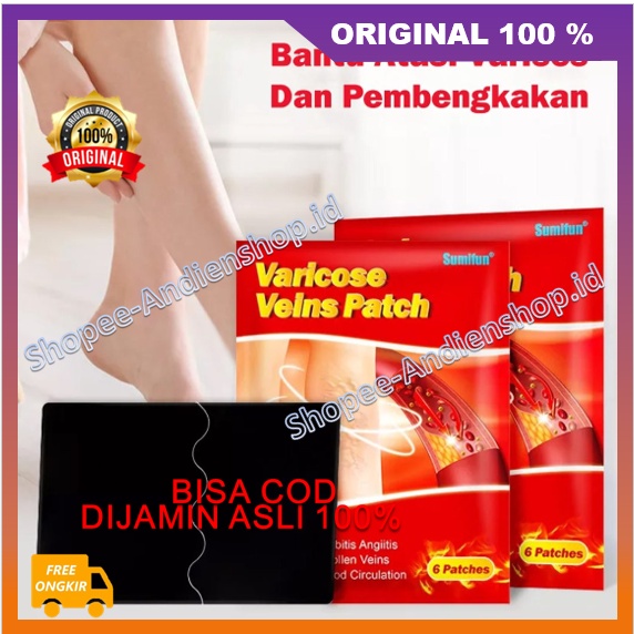Varises Patch Koyo Herbal Penghilang Varises Vaskulitis Parises Urat Menjol Ampuh 100% ASLi