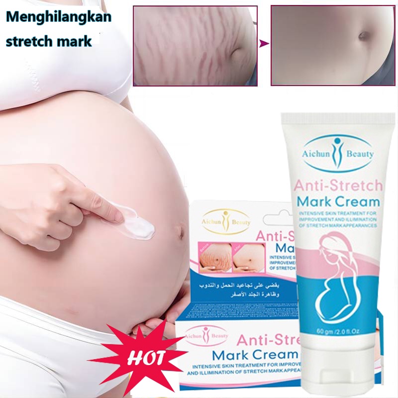 AICHUN Anti-stretch Mark Cream 60G - Strechmark Cream Krim Strech Mark Pascamelahirkan Krim Anti Strechmark Penghilang Bekas Luka