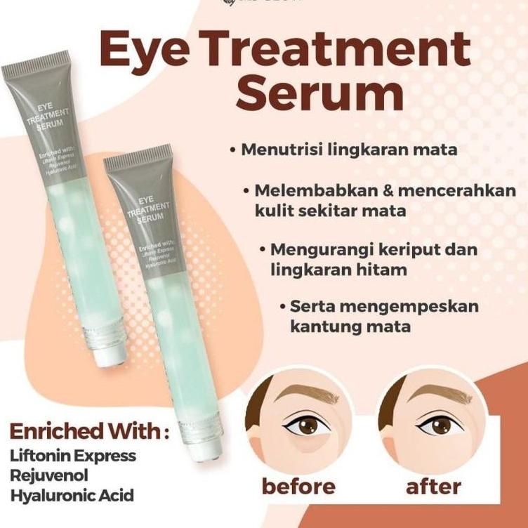 ℮ EYE CREAM MS GLOW ORI EYE DARK CIRCLE CREAM - CREAM MATA eye treatment ms glow ❄