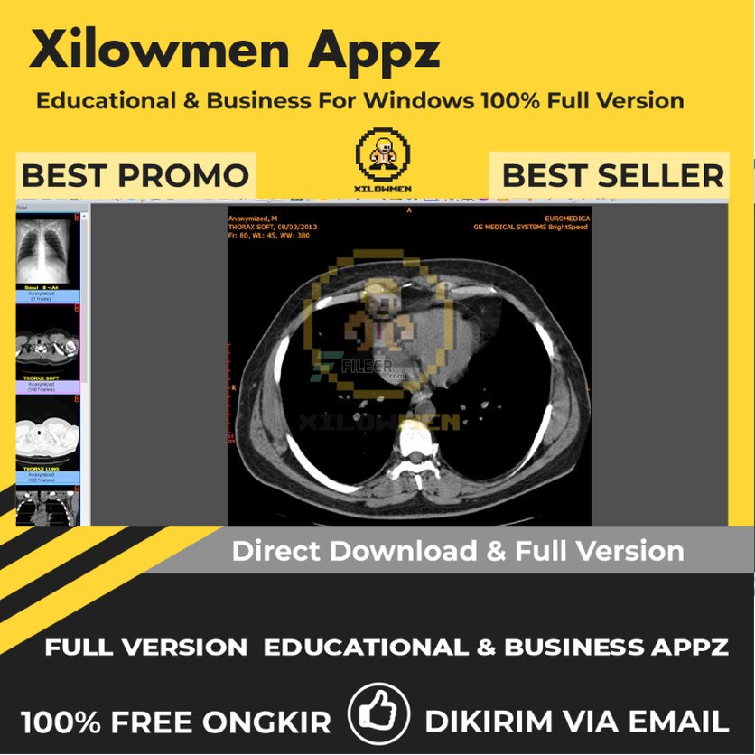 [Full Version] Sante DICOM Editor 3D Pro Educational Business Lifetime Win OS