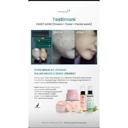 (NEW)SABUN JERAWAT, BERUNTUSAN, KOMEDO, WAJAH SENSITIVE ,WAJAH IRITASI AKIBAT GANTI GANTI SKINCARE ,FACIALWASH TERBARU