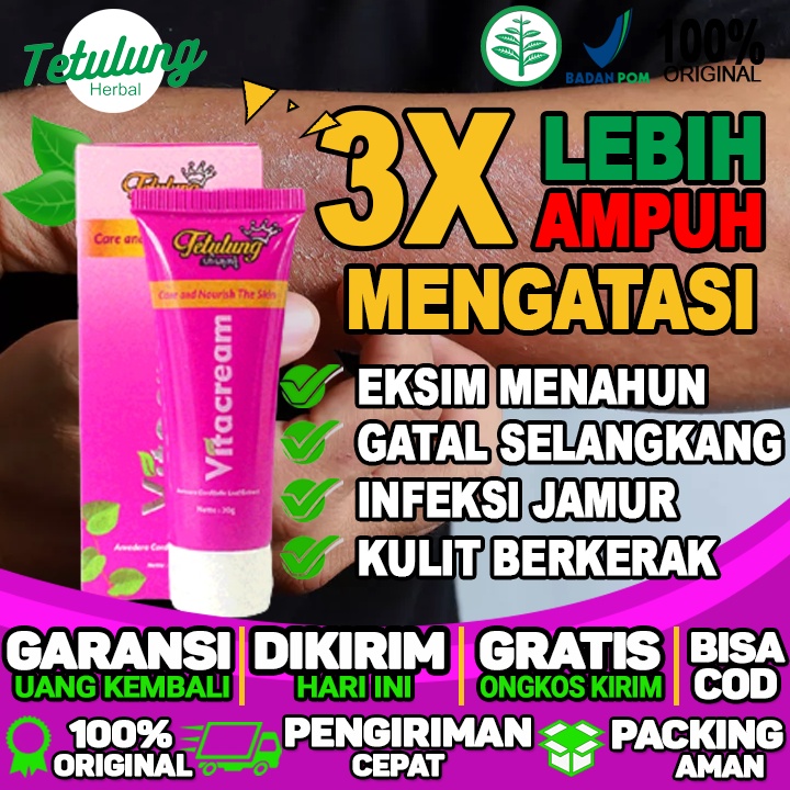 obat Salep eksim di tangan obat eksim di selangkangan obat eksim di wajah obat eksim Paling Ampuh