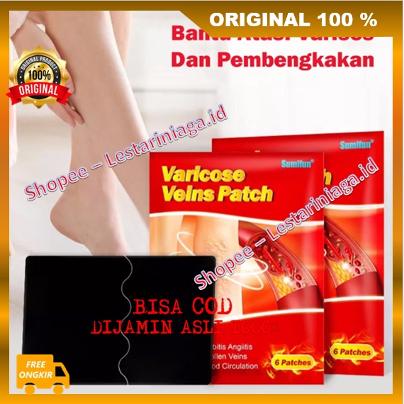 Varises Patch Koyo Herbal Penghilang Varises Vaskulitis Parises Urat Menjol Ampuh ORIGINAL