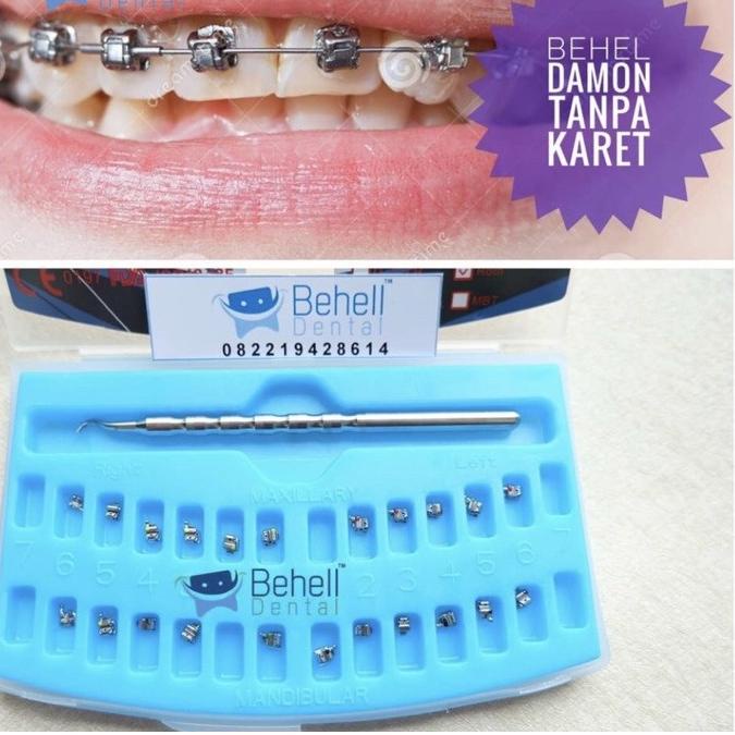 Discount | KI3 | BRACKET BEHEL DAMON SISTEM METAL USA : SELF LIGATING . DAMOND SYSTEM ORIGINAL BEHEL