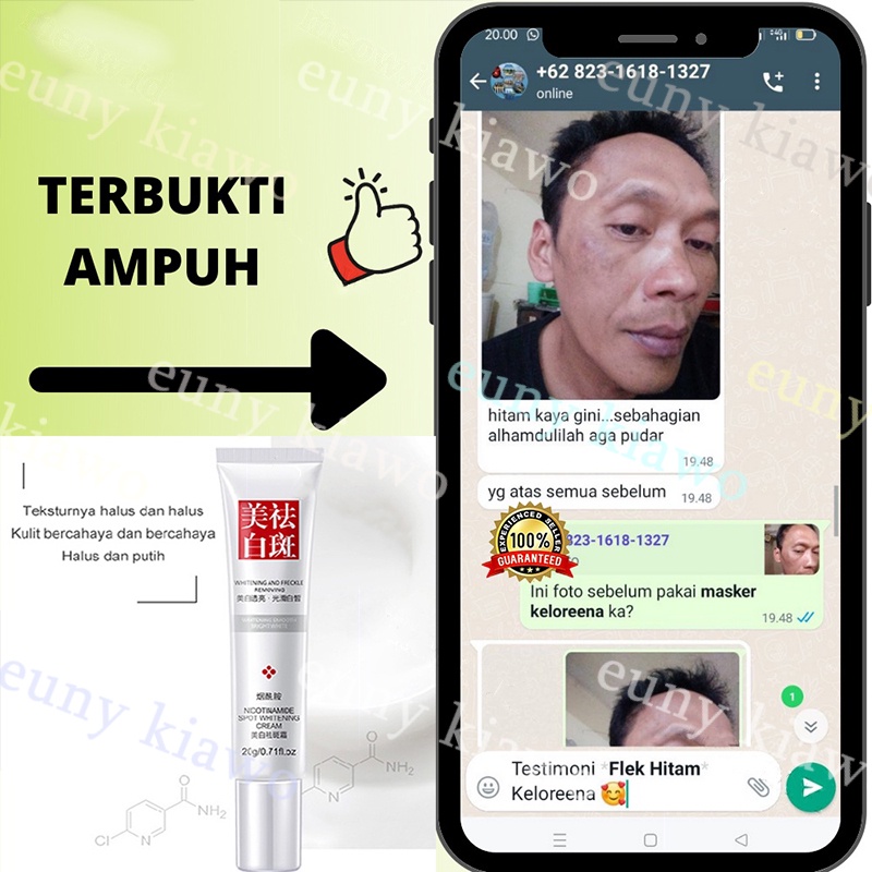 Cream penghilang flek hitam Krim pemutih wajah Krim bintik pemutih Krim penghilang flek 20G Remove Dark Spots Anti Freckle Cream Niacinamide Fade Pigmentation Melasma Brighten Creams concealer focallure