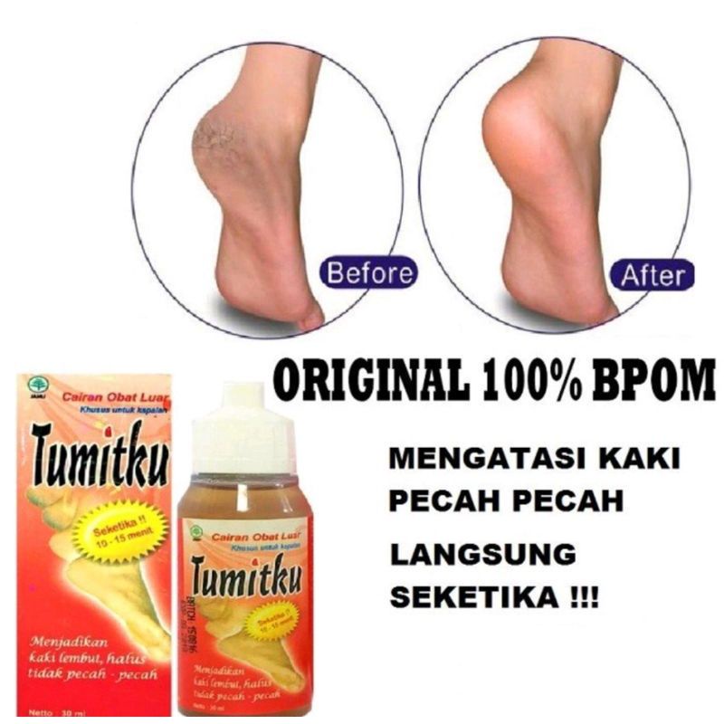 tumitku obat kaki kapalan dan pecah-pecah Original BPOM