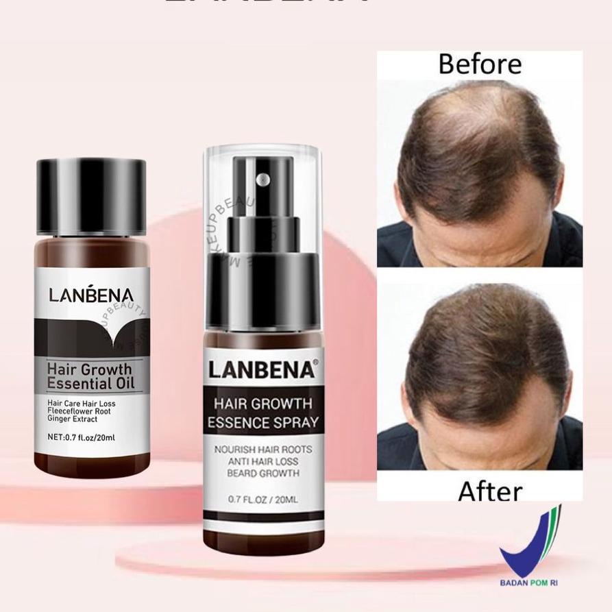 ❉ [] LANBENA Hair Growth Essential Oil 20ml | Essence Spray 20ml - Mencegah Kerontokan ✪