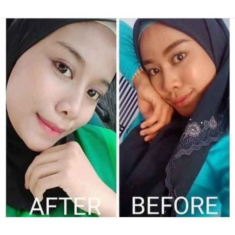 BISA COD  Paket Normal Glowing Paket Glowing Terlarir Termurah Ampuh Memutihkan Wajah Extra Cepat Paket Zayora Isi 4