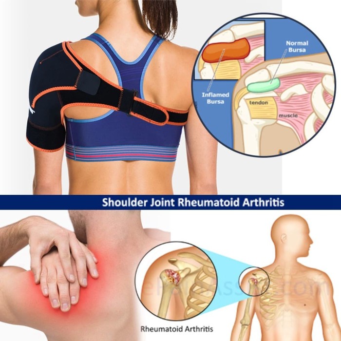 Shoulder Support / Shoulder Brace / Penyangga Bahu / Deker Bahu /Alkes