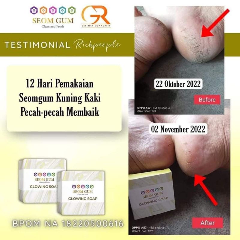 SEOM GUM ORIGINAL GLOWING SOAP / FEMININE SOAP
