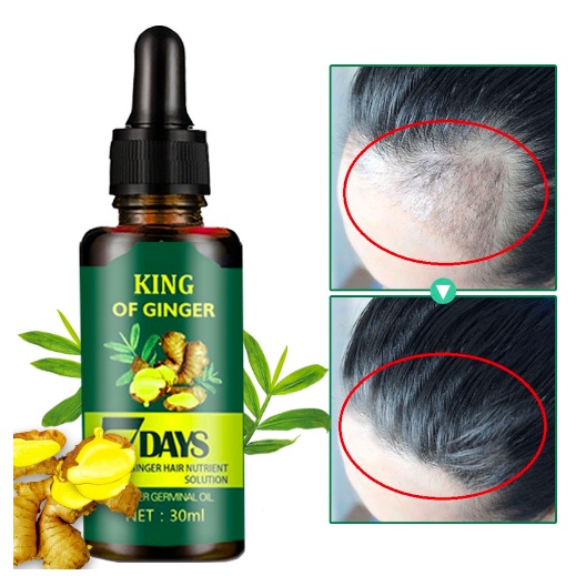 SERUM RAMBUT ANTI BOTAK DAN ANTI RONTOK Nutrisi Rambut Jahe isi 30ml