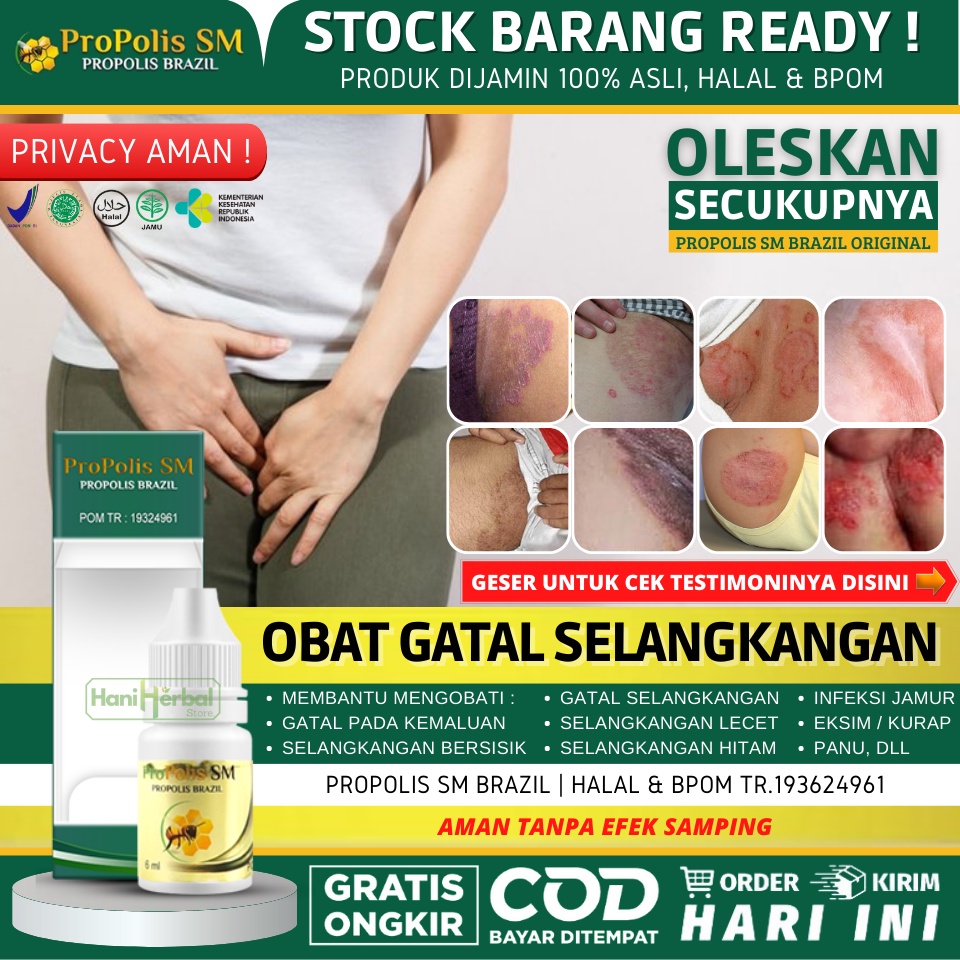 Obat Gatal Bruntusan di Selangkangan 100% Alami - Salep Selangkangan Gatal & Kering Akibat Jamur, Pe
