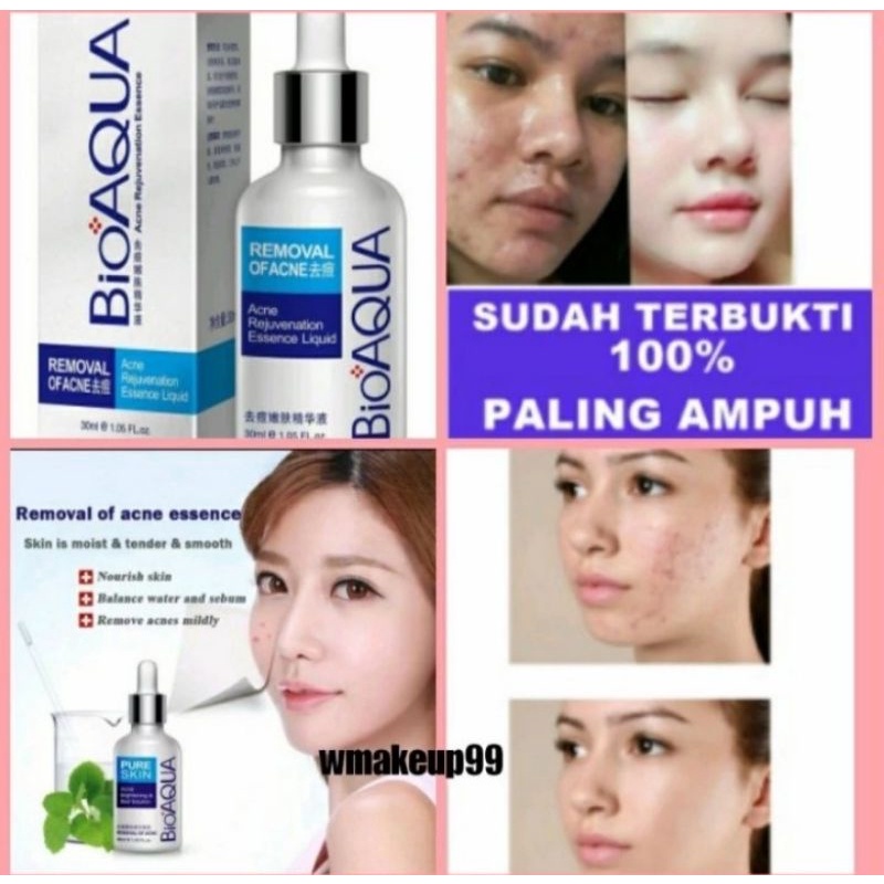 Bioaqua pure skin  removal of acne serum anti jerawat ampuh original
