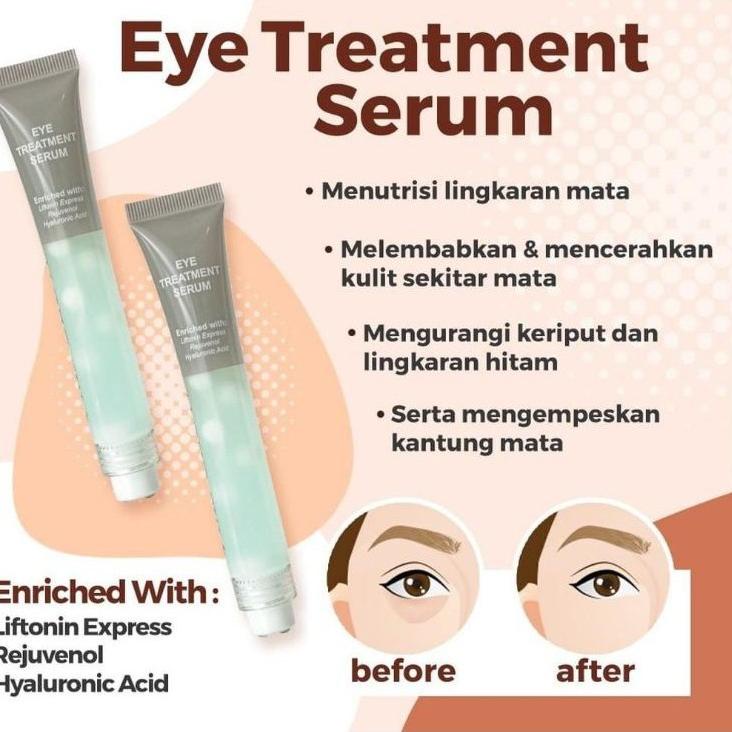 ☺ EYE CREAM MS GLOW ORI EYE DARK CIRCLE CREAM - CREAM MATA eye treatment ms glow ✧