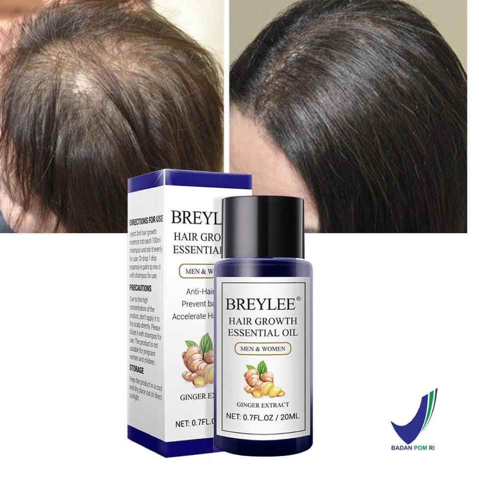 ➩ [] BREYLEE Hair Growth Essential Oil 20ml (Serum Penumbuh Rambut - Mencegah Kerontokan) ❊