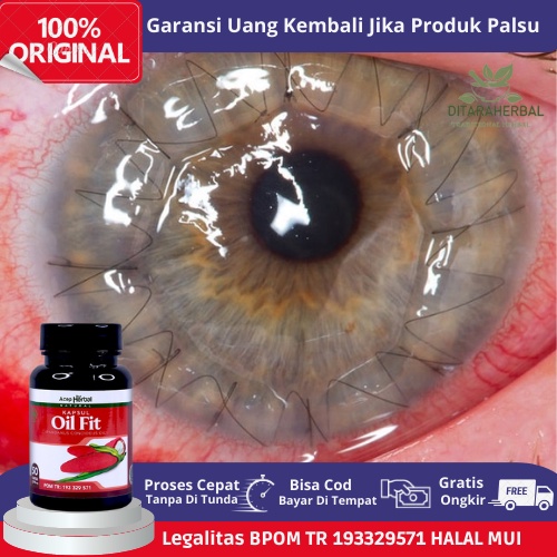 Obat Nyeri Pada Mata, Obat Mata Merah, Obat Infeksi Kornea Mata, Obat Peradangan Kornea Mata, Obat K