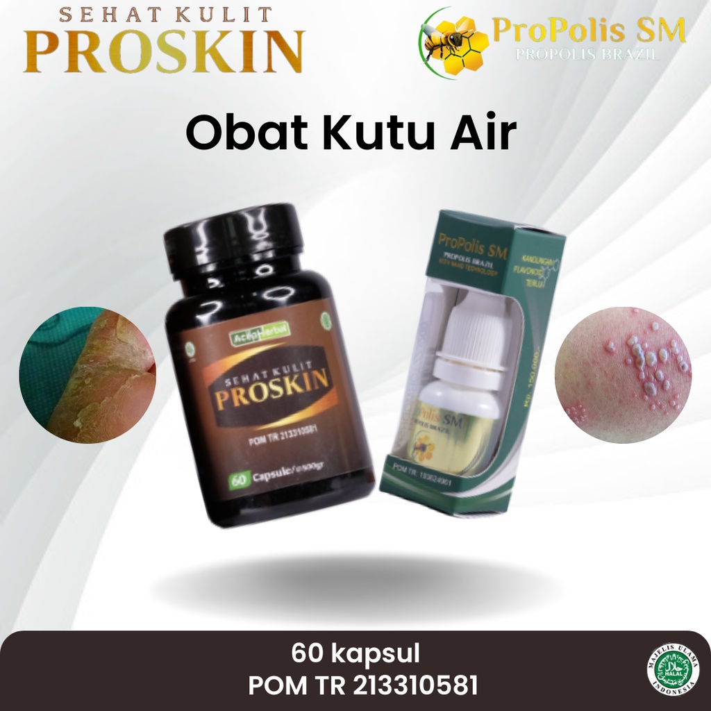 Obat Kutu Air, Kutu Air di Kaki, Kutu Air di Tangan, Kutu Air di Sela Kaki, Kutu Air Ruam Dan Gatal,