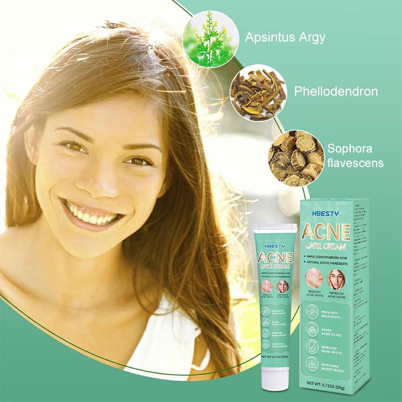 [HBESTY Impor] Cream jerawat Acne spot Salep jerawat Obat totol jerawat30G Menghilangkan bekas jerawat lama dan lubang jerawat peradangan kulit tak efek samping cream jerawat dan bekas jerawat ampuh