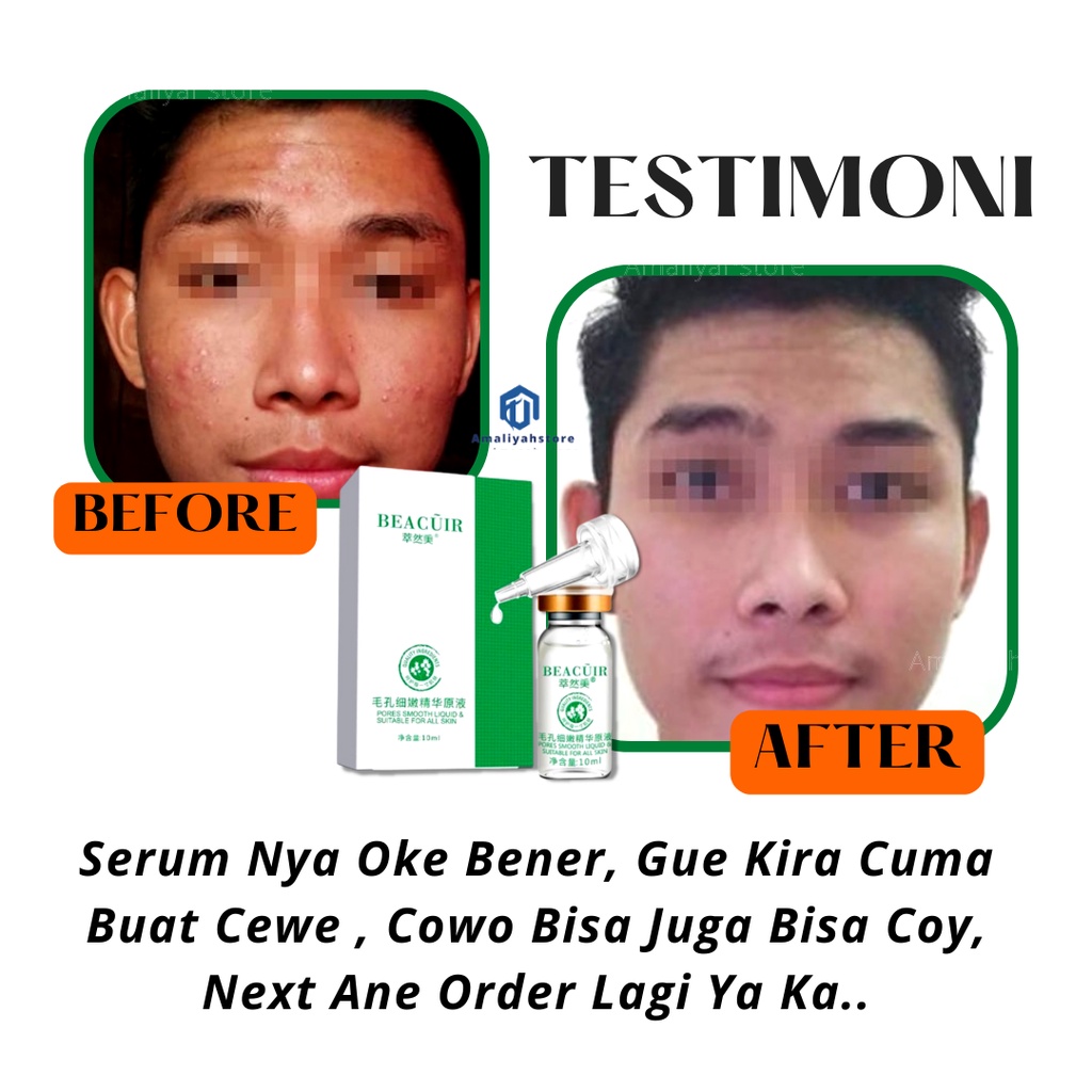 Serum Beacuir Pengecil Pori Pori Besar Wajah Penghilang Bekas Jerawat Bopeng Beruntusan Dan Flek Hitam Membandel Di Muka Ampuh Pria Dan Wanita Original