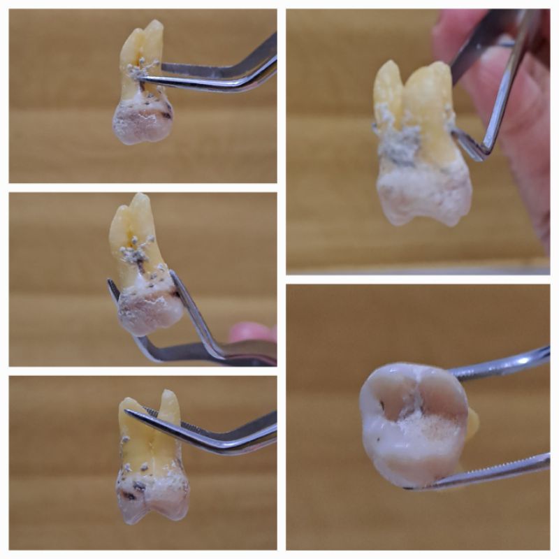 [UNSUR GIGI PRAKTIKUM] Gigi Molar Rahang Atas Murah