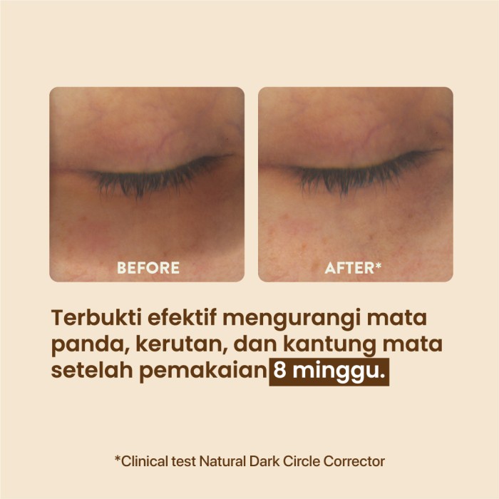 NPURE Marigold Eyemazing Power Serum Mata Anti Kerutan Dark Circle