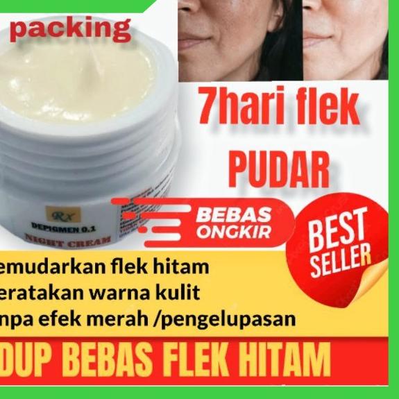 ☆ WOLGEN CREAM FLEK HITAM PENGHILANG FLEK HITAM MELASMA FLEK BANDEL MENAUN ➢