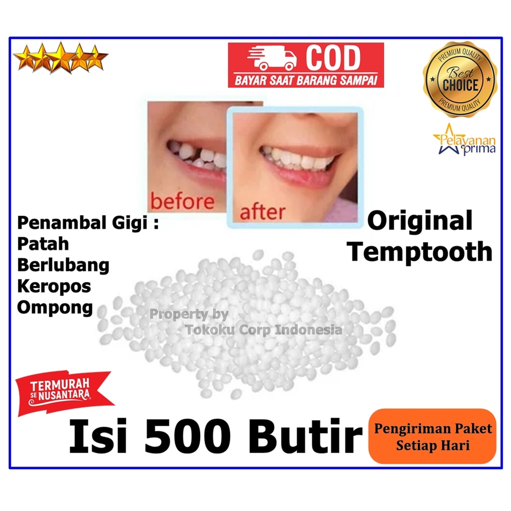 Temptooth Isi 500 Butir Penambal Gigi Berlubang Tambal Gigi Patah / Temtot Gigi Patah