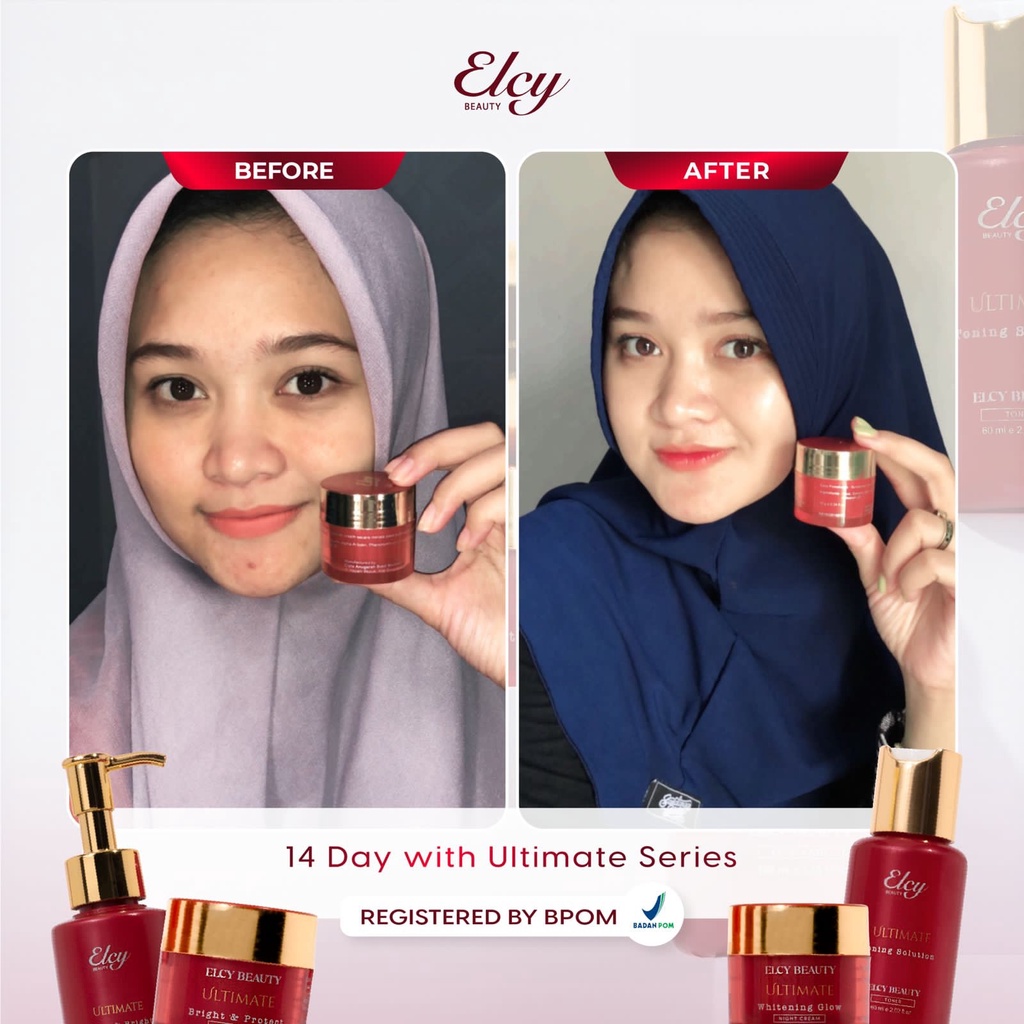 [BPOM] ELCY BEAUTY TERBARU ULTIMATE LC BEAUTY KF SKIN Paket/Ecer Krim Siang /Cream Malam /Toner Cleanser/ Sabun Facial Wash Serum LCBeauty/Klinik/Clinic