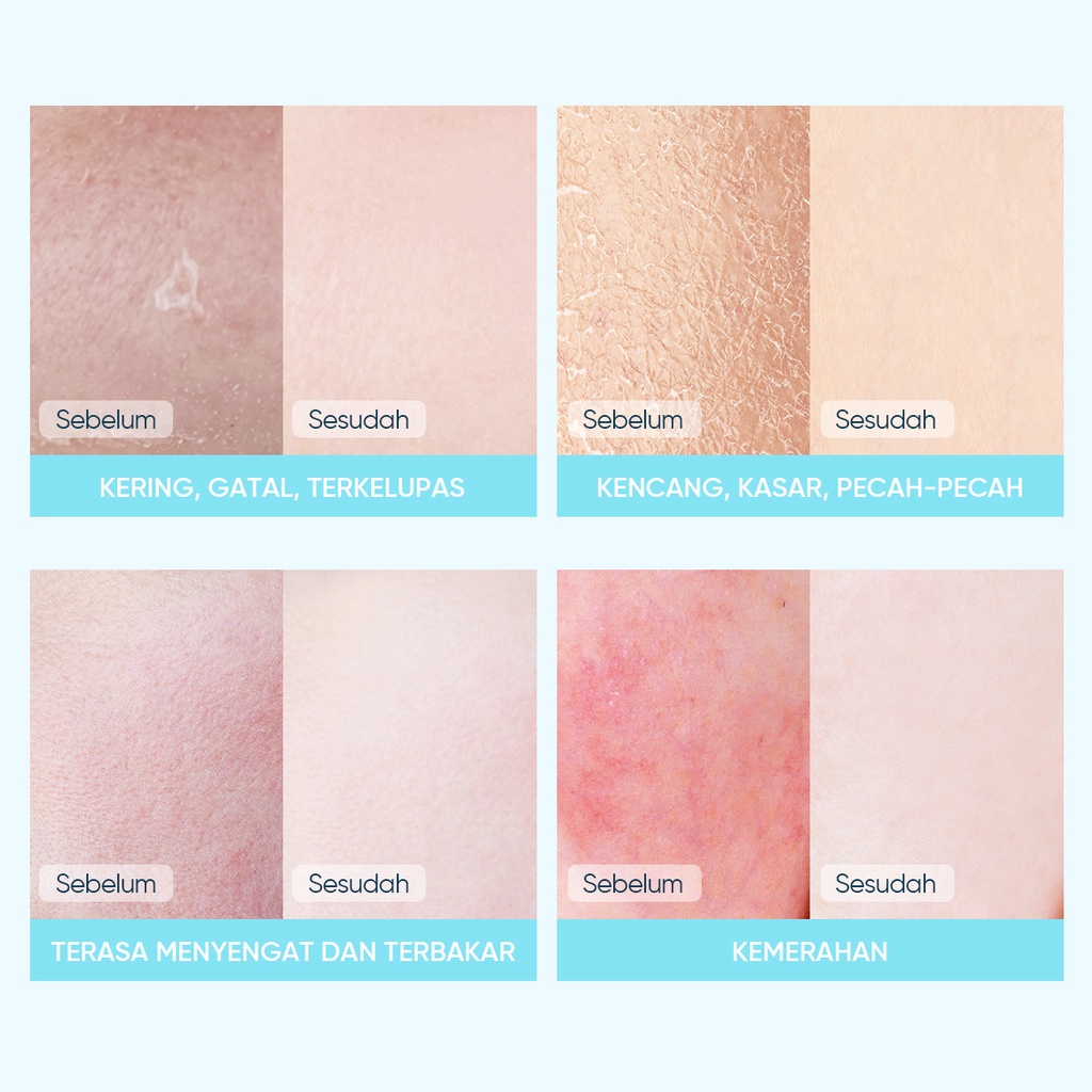 SKINTIFIC 5X Ceramide Soothing and improveing Mask 100% Ori Skintific Mask Masker Wajah Facial Mask Skintific Mask Soothing Mask Sheet Mask