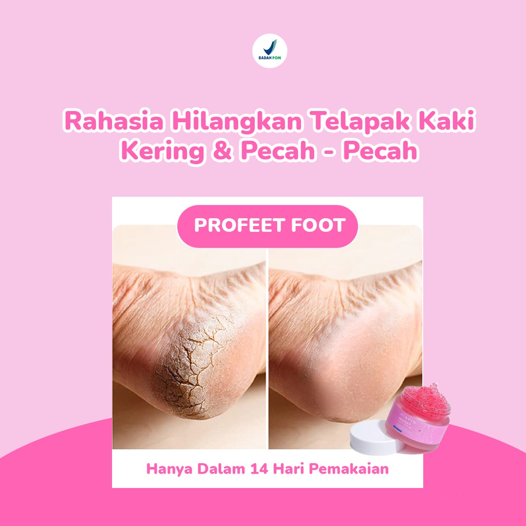 PIW PIW Foot Scrub Merawat Kaki Pecah Pecah Pengangkat Sel Kulit Mati