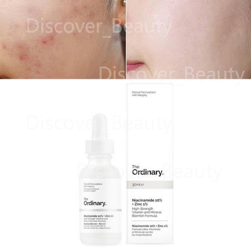 The Ordinary Niacinamide10%+Zinc1% Serum 30ml Untuk Mencerahkan Warna Kulit Dan Mengecilkan PoriPori