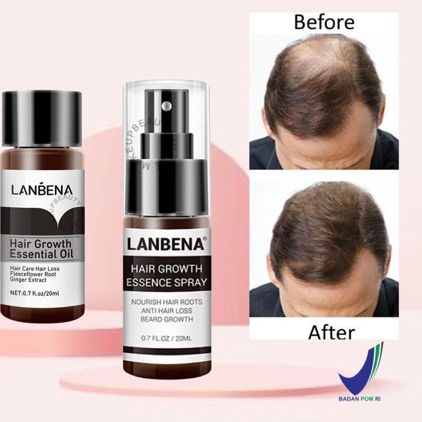 ➻ [] LANBENA Hair Growth Essential Oil 20ml | Essence Spray 20ml - Mencegah Kerontokan ❄