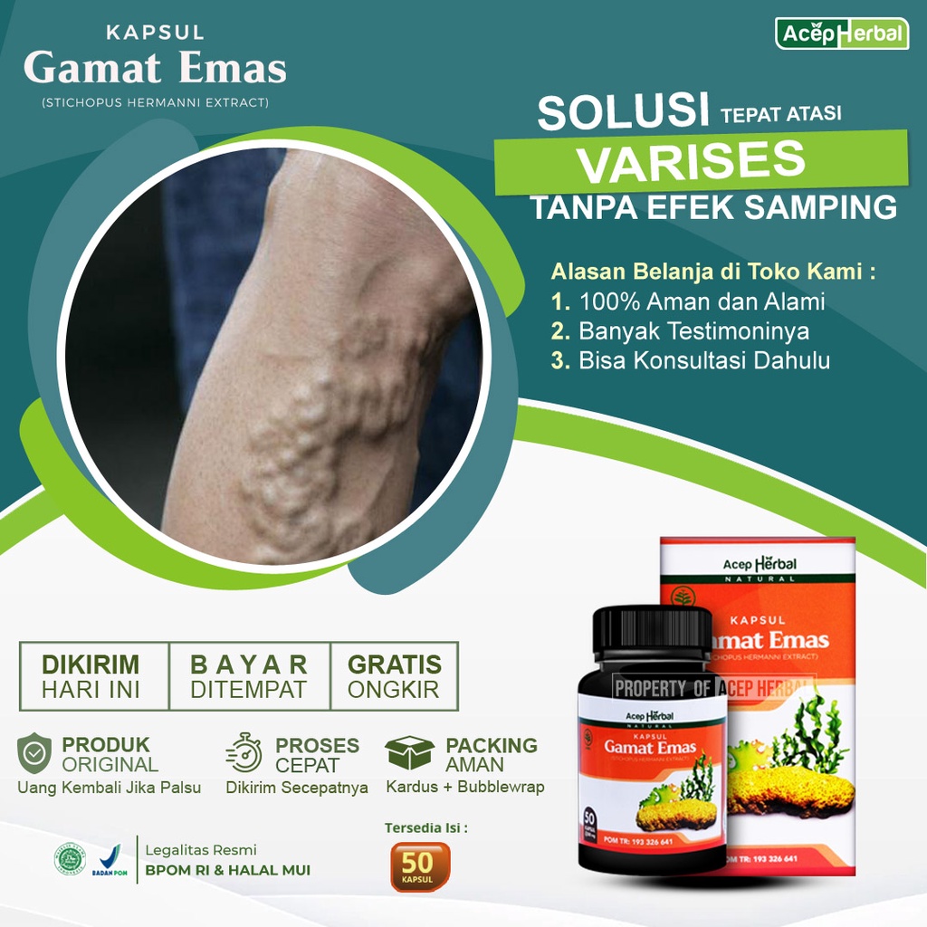 Obat Varises Tonjolan Urat Turun Berok Hernia Benjolan Urat Kelamin Turun Peranakan - Gamat Emas Kap