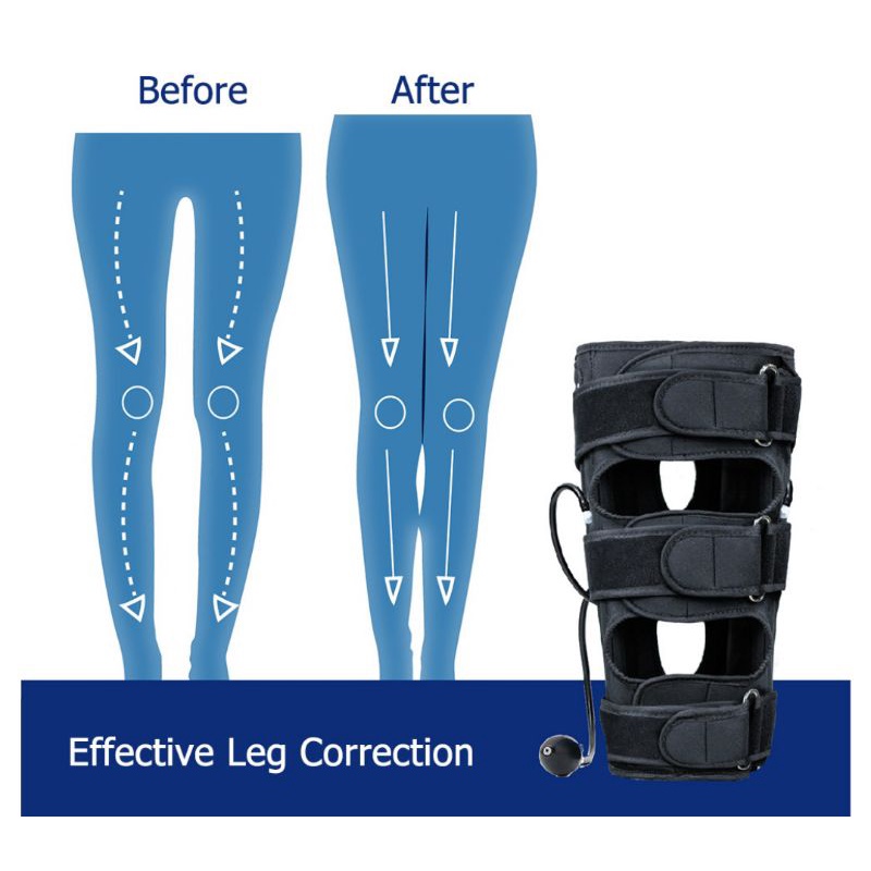 Alat Meluruskan kaki leg correction terapi X Pelurus kaki O X kaki X O