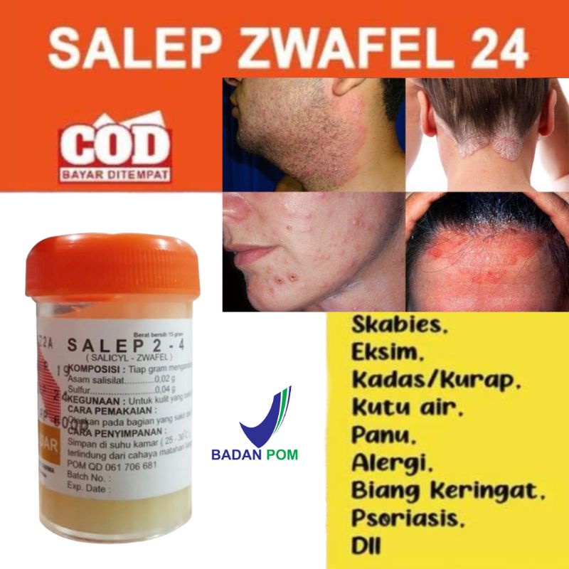 Salep zwafel 24 Obat Salep Gatal Paling Ampuh Gatel Kulit Panu Kadas Jamur Eksim Kutu Air Jerawat Selangkangan