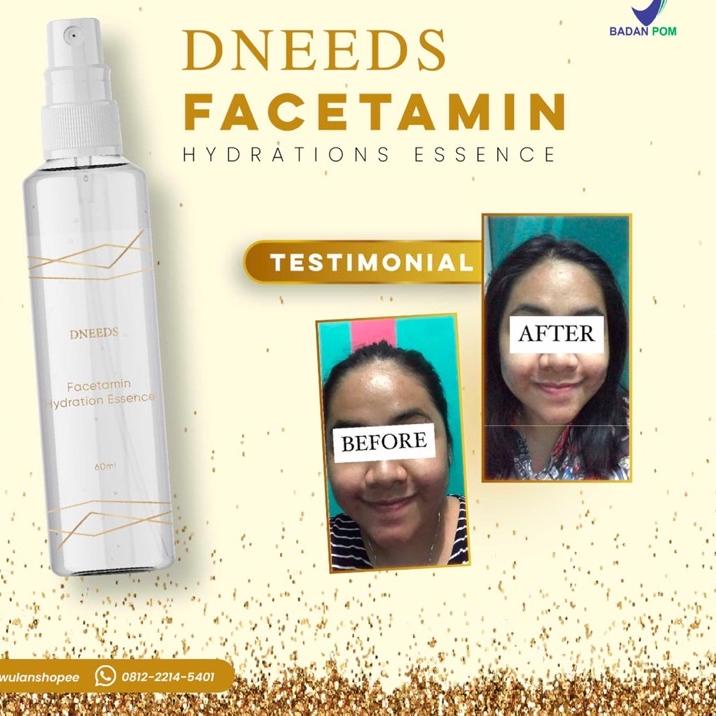 ► DNEEDS FACETAMIN ESSENSE ✴