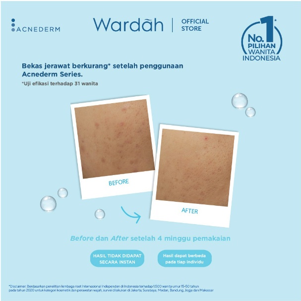 Wardah Acnederm Pure Foaming Cleanser 60 ml - Pembersih Wajah Berjerawat dan Berminyak
