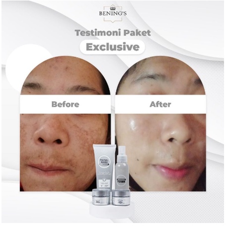 Benings Exclusive Series | Bening Skincare Doctor Oky Pratama