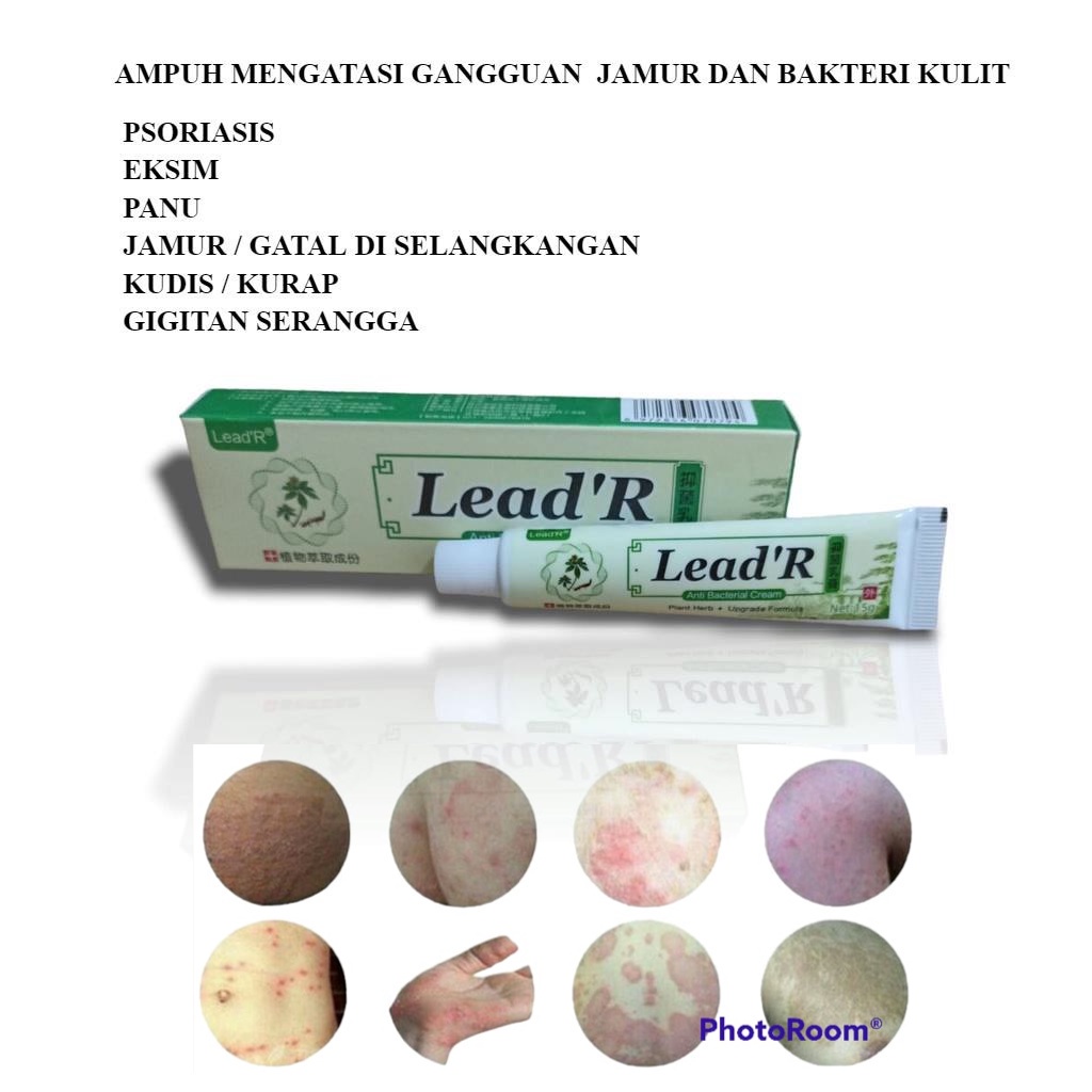 HARGA PROMO !!! ANTI BACTERIAL CREAM LEAD'R DENGAN FORMULA BARU 5 X LEBIH AMPUH Salep Gatel Sakit Kulit Eksim Original isi 15Gr Psoriasis Eksim Jamur Kurap Alergi Kulit Cream SALEP ZUDAIFU OBAT GATAL ALERGI KULIT PANU KURAP JAMUR SELANGKANGAN