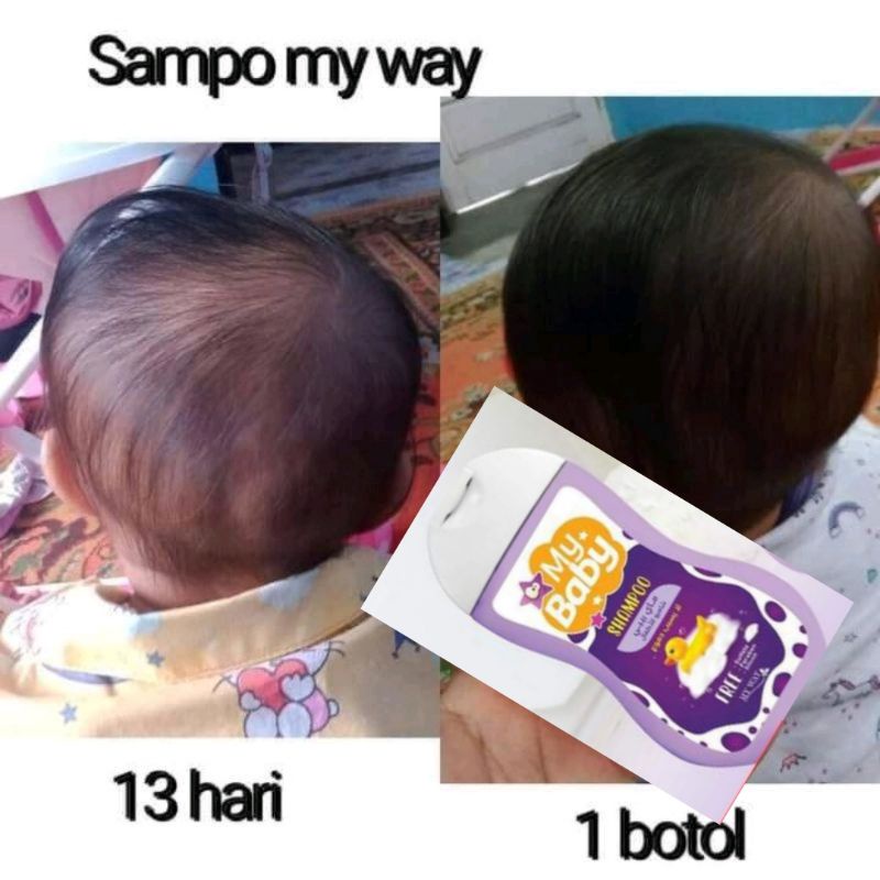 My Baby shampo penumbuh rambut my way import Mesir original // Baby zinc cream my way original