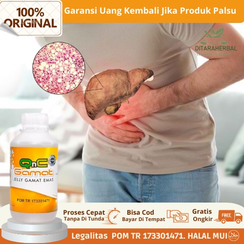 Obat Limpa Bengkak, Obat Pembengkakan Limpa, Obat Limpa Membengkak, Obat Herbal Pembesaran Limpa, Ob