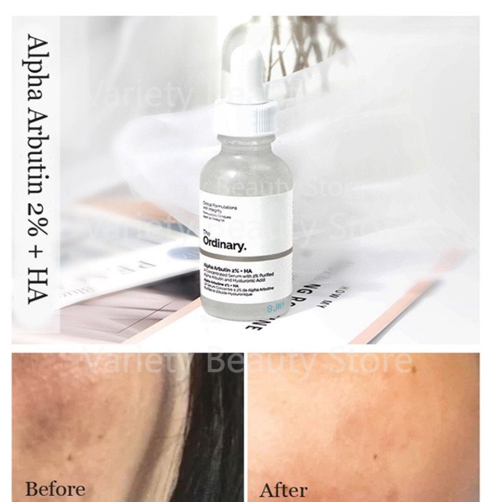 The Ordinary Alpha Arbutin 2% + HA 30ml Concentrated Whitening Face Serum