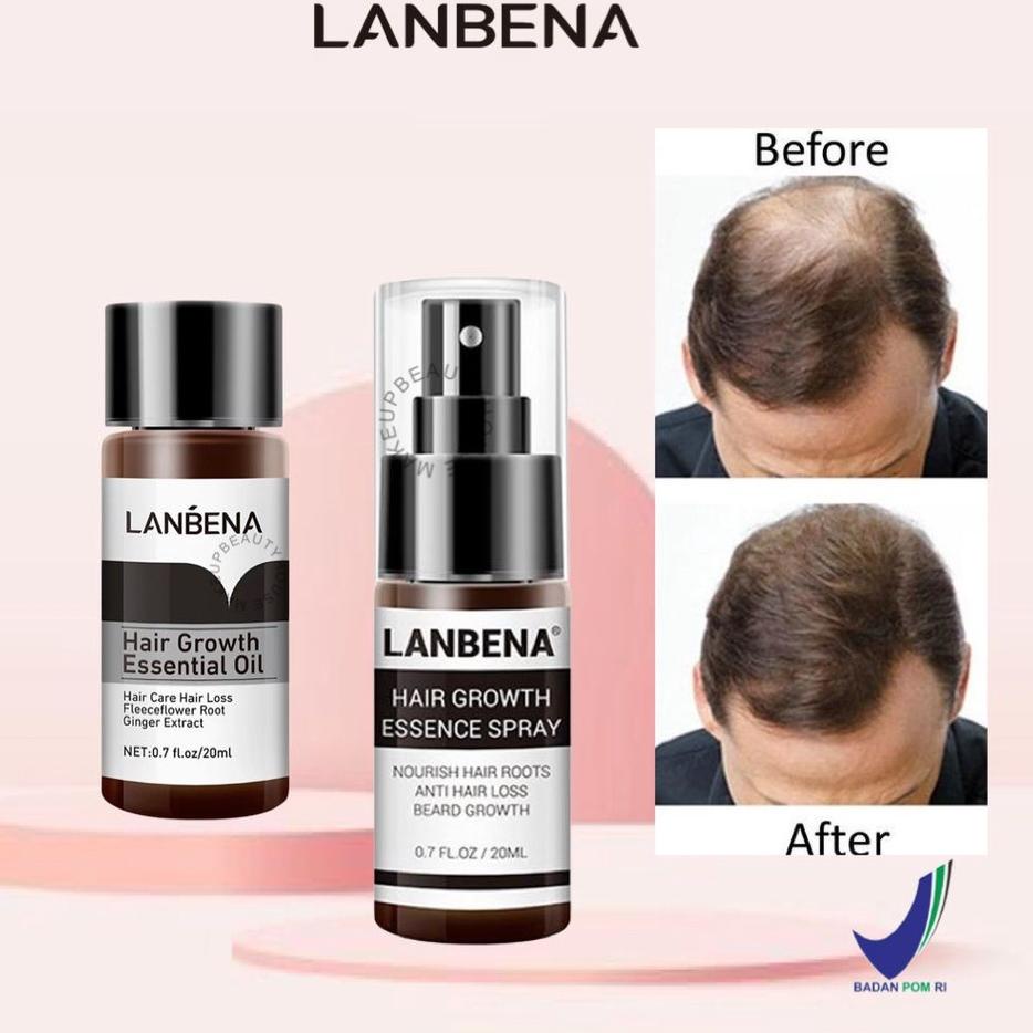 ♧ [] LANBENA Hair Growth Essential Oil 20ml | Essence Spray 20ml - Mencegah Kerontokan ❄