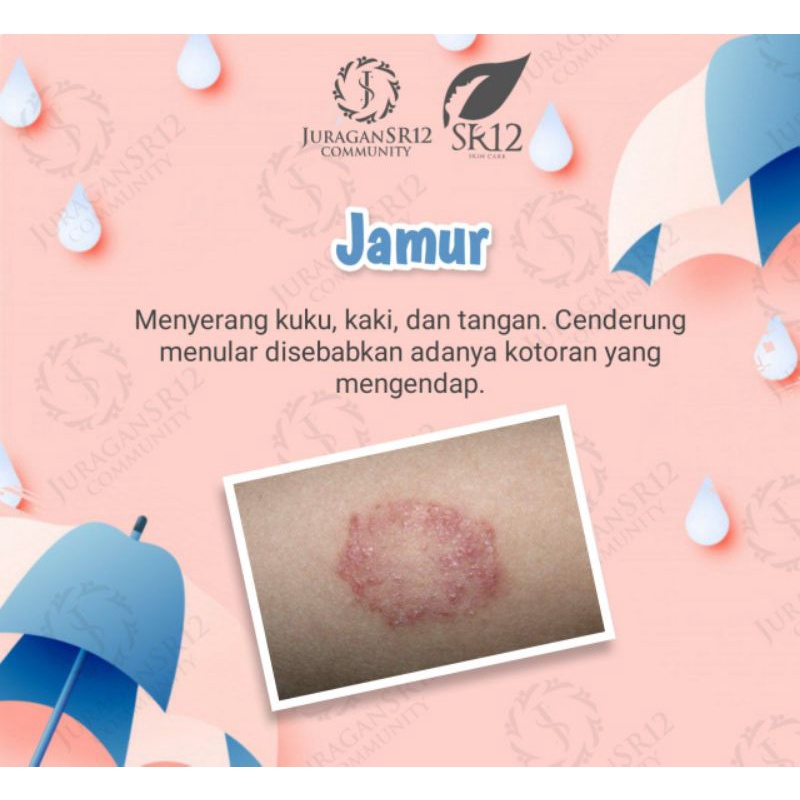 Obat Gatal Gatal Bayi - Ruam Popok - Bruntusan - Biang Keringat 100% Alami