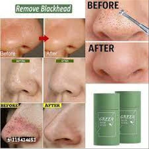 𝗚𝗿𝗲𝗲𝗻 𝗠𝗮𝘀𝗸 𝗦𝘁𝗶𝗰𝗸 𝗠𝗘𝗜𝗗𝗜𝗔𝗡 Green Mask Stick 100% Original Perawatan Wajah Masker Hilangkan Komedo Kotoran di Wajah