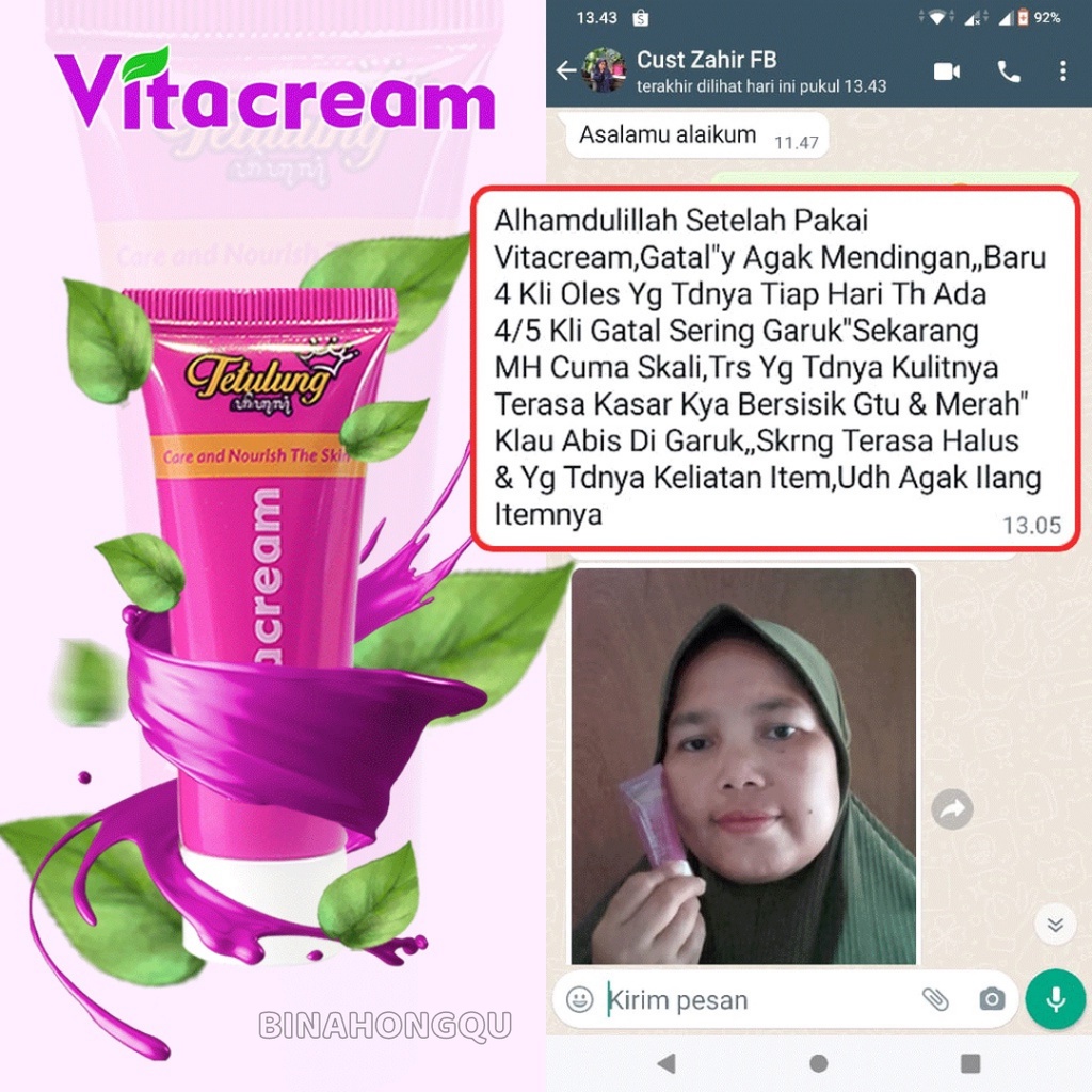 Tetulung Vitacream 20g - Salep Obat Gatal Jamur Selangkangan Hitam,Salep Gatal Selangkangan dan Kema