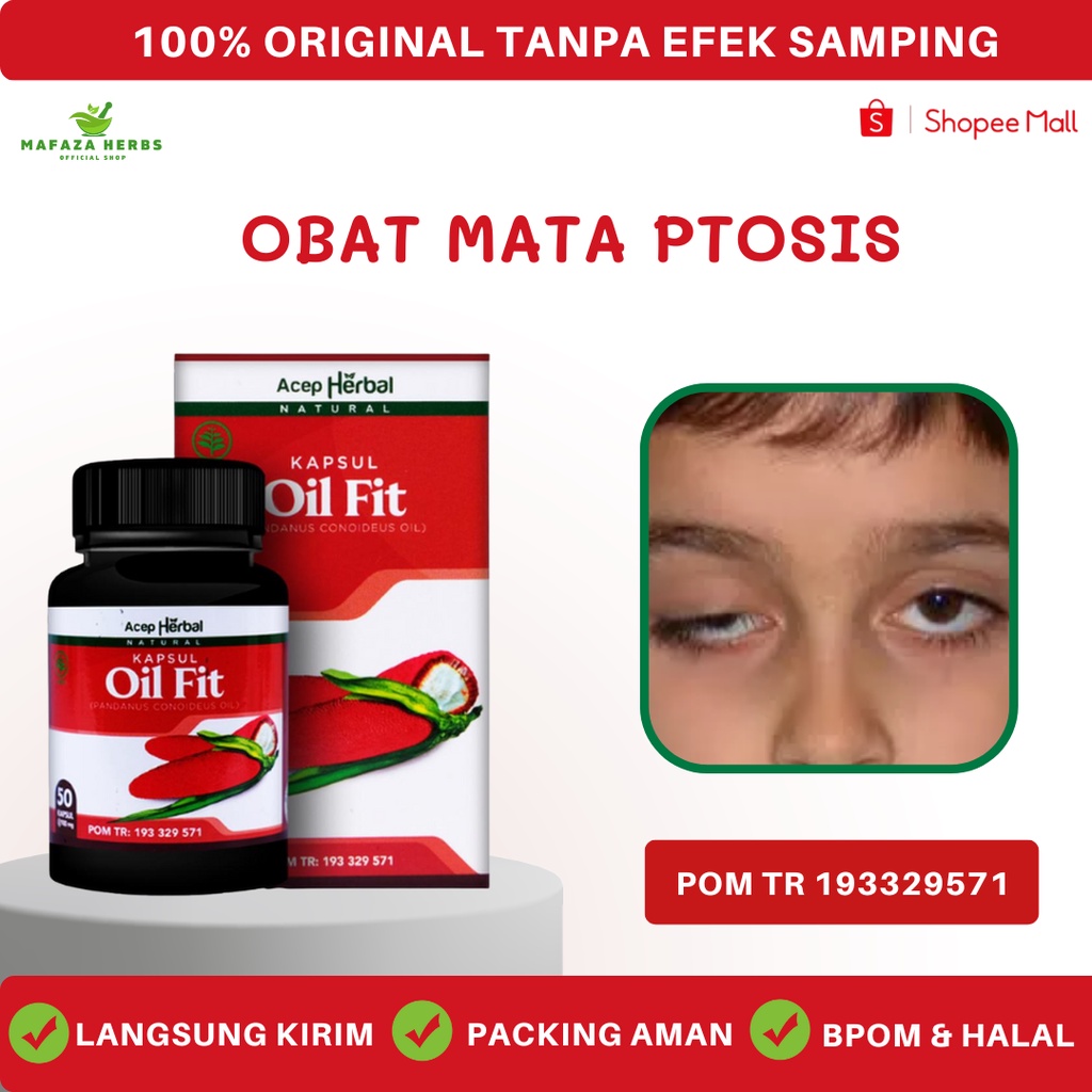 Jual Mafaza Herbs Obat Mata Ptosis Mata Beda Sebelah Mata Sipit