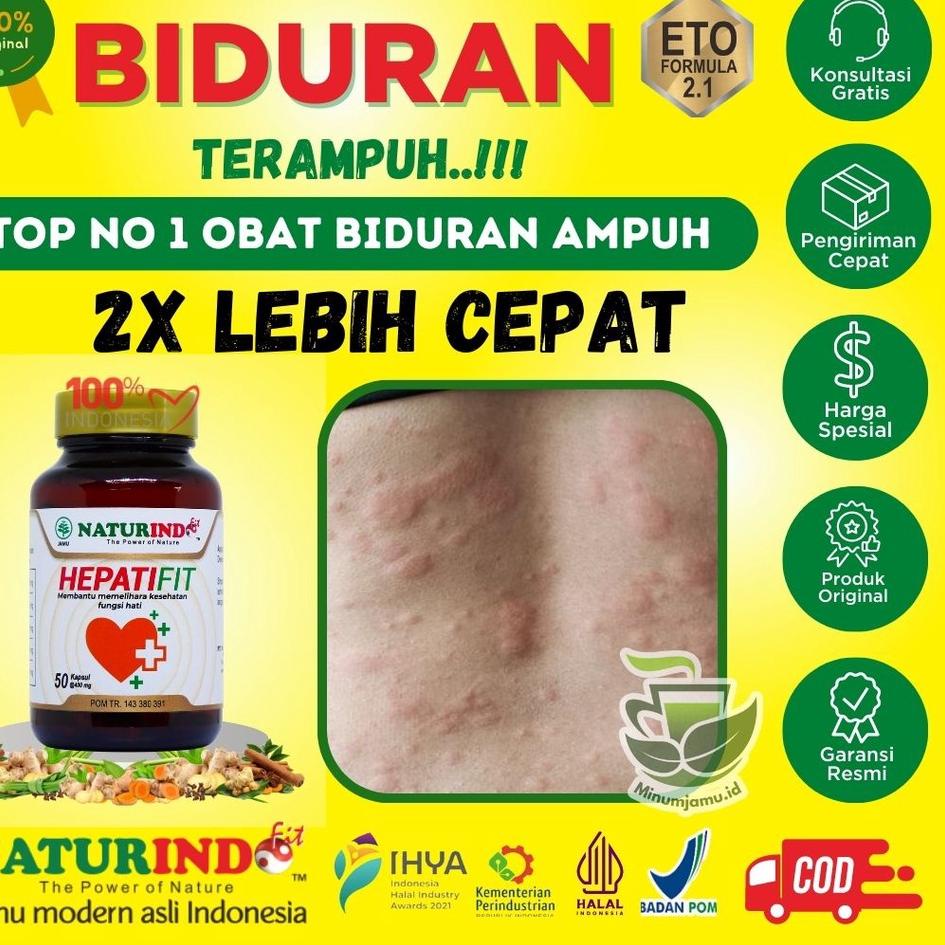 COD - Obat Gatal Kulit Alergi Dingin Biduran Gatal Alergi Herbal Bentol Kulit Panu Eksim Biduran Amp